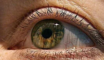 La vitamina B3 podría ser muy eficaz para prevenir el glaucoma