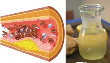 Siempre tenía el colesterol y la presión alta, pero mi abuela me dio esto y le dije: ¡ADIÃ"S PASTILLAS!