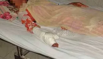 Padre balea su hija paquistaní por casarse contra los deseos de su familia