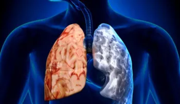 El desarrollo de los pulmones en los primeros años, clave para evitar EPOC