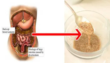 Elimina todos los depósitos de grasas acumulados en tu cuerpo, tomando esta mezcla (VIDEO)