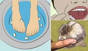 Metí los pies en agua de ajo, poco después esto pasó en mi cuerpo. ¡INCREÍBLE! ¡Inténtalo!