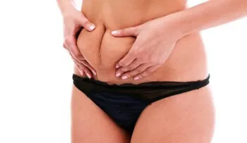 9 alimentos que ayudan a eliminar la grasa abdominal