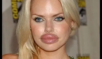 Labios estropeados (FAMOSOS) !!!