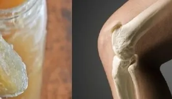 Los huesos y las articulaciones pueden ser curadas con la gelatina 