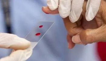 Análisis de sangre detecta virus afectaron a una persona en su vida