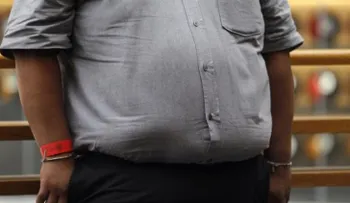 Dieta, estilo de vida y estigma provocan aumento de obesidad en Latinoamérica