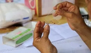 Impacto de COVID-19 en sistemas de salud puede elevar muertes por VIH o malaria
