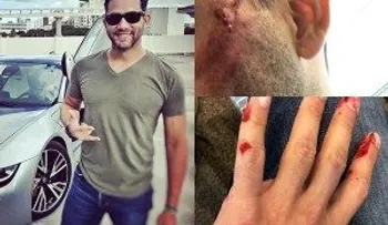 Sergio Carlo sufre un aparatoso accidente y tiene "llevao en to laooo"