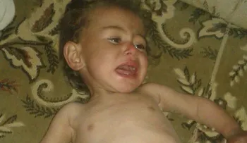 Hambruna en Siria: lo que se vive en Madaya solo es la punta del iceberg