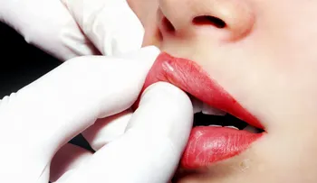 ¿El Botox es la nueva panacea? Los increíbles usos posibles de la droga