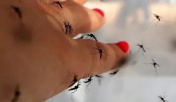 Bebés en peligro: los casos de microcefalia aumentan en Latinoamérica