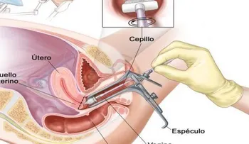 Una mujer murió debido a cáncer de útero: estos son los síntomas que ignoró