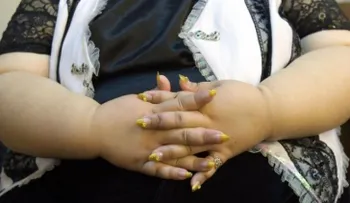 Cómo afectan los kilos de más en las relaciones 