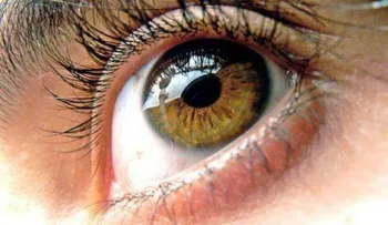 5 remedios para tratar el síndrome del ojo seco