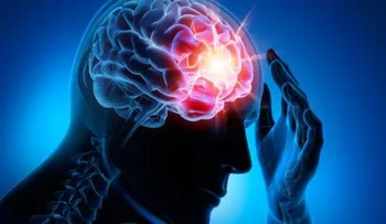 Las cuatro enfermedades cerebrovasculares más comunes que debes conocer