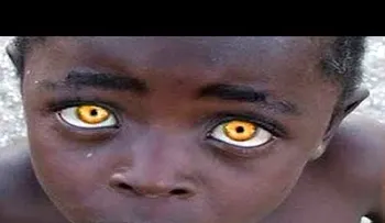 Estas son las 10 personas con color de ojos únicos en el MUNDO 