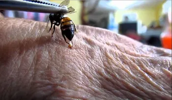 Hallan cura contra el SIDA; mundo celebra descubrimiento