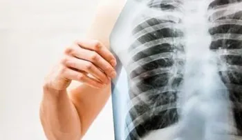 Como limpiar tus pulmones de la nicotina