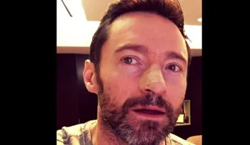 Hugh Jackman vuelve a ser intervenido por cáncer de piel
