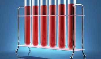 Cómo detectar los resultados de un análisis de sangre