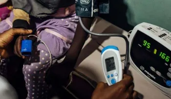 Los oxímetros de pulso fallan más en pacientes negros, según un estudio