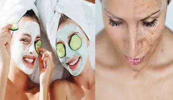 De que funciona, funciona: Una receta que eliminas las manchas de tu piel y rostro!