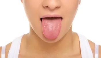 Color y textura de la lengua y su significado