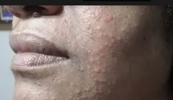 Mascarilla produce reacción rostro de la presidenta del CDP 
