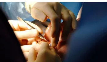 Una mujer completamente ciega recupera la visión con un trasplante de su diente en el ojo