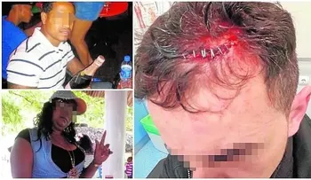 14 personas heridas por pelea entre Policías y dominicanos en Madrid  (VIDEO) 