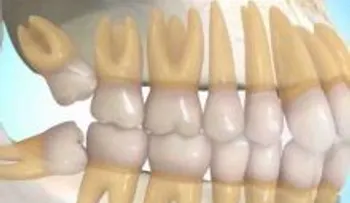 Esta es la estafa dental más grande del MUNDO: los odontólogos te dicen otra cosa