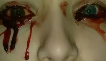 El extraño caso de la niña que llora sangre