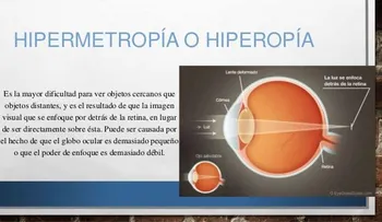 Daltonismo, (defecto de la vista), más frecuente en hombres que en mujeres