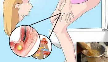 Los médicos están sorprendidos: Una cerveza de jengibre casera que cura 10 enfermedades del cuerpo