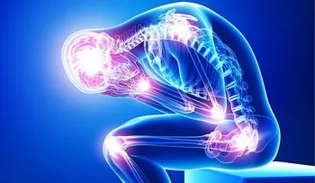 10 potentes analgésicos naturales contra el dolor