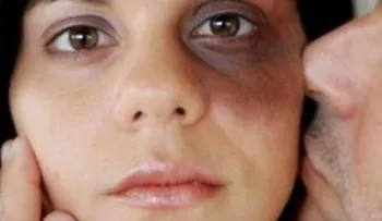 Si una mujer acepta estas 5 cosas de un hombre, debe ir ahora mismo donde un psicólogo