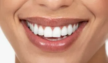 10 tips para fortalecer tus dientes