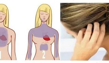 Cómo utilizar tu cabello para saber si vas a tener un ataque al corazón y prevenirlo