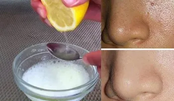 Anota: Cómo quitar TODA la grasa de la cara en 5 minutos, con solo estos 2 ingredientes!!!