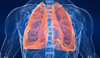 La Tuberculosis: Principal asesino infeccioso  en el mundo 