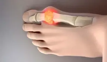 Elimina los cristales de ácido úrico de articulaciones con este simple remedio a base de pepino