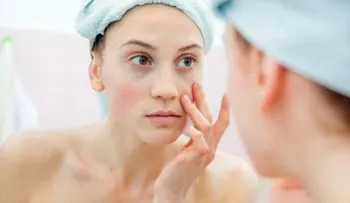 Las ojeras revelan tu actitud hacia la vida
