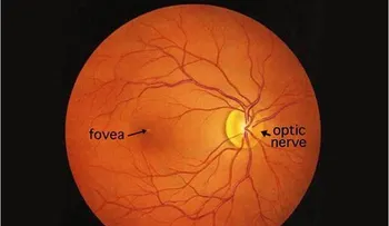 DMAE: crean células de la retina a partir de células madre