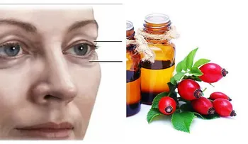 No es necesario un corrector para cubrir las ojeras: Usa aceite rosa de mosquea