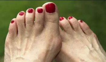 6 intervenciones por salud que mejoran tu estética