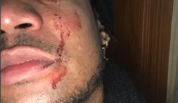 Hieren a Vakeró durante intento de asalto en San Pedro