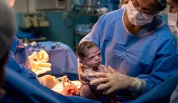 El increíble comportamiento de una bebé, que no lloró al nacer, y puso una cara de enojo 