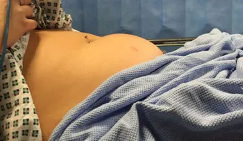 Ella casi muere por un tampónâ?¦