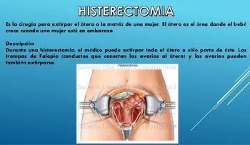 La extirpación del útero: Consejos antes y después de la intervención 
